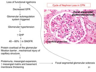 Loss of functional nephrons
                                            Cycle of Nephron Loss in CPN
            Decreased GFR


      Glomerular autoregulation
          system triggered


       Glomerular hypertension


                ↑ GHP

        40 – 60% ↑ in SNGFR

Protein overload of the glomerular
filtration barrier , mechanical injury of
capillary structure


Proteinuria, mesangial expansion,
                                              Focal segmental glomerular sclerosis
↑ mesangial matrix and basement
membrane thickening                                                        81
 