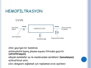 HEMOFİLTRASYON
oYarı geçirgen bir membran.
oHidrostatik basınç plazma suyunu filtreden geçirtir
(ultrafiltrasyon).
oKüçük moleküller su ile membrandan sürüklenir (konveksiyon).
oUltrafiltrat atılır.
oSıvı dengesini sağlamak için replasman sıvısı ayarlanır.
 