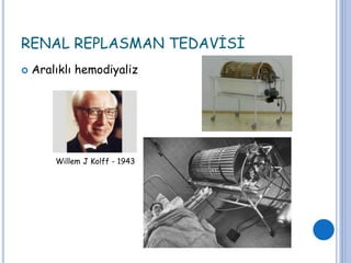 RENAL REPLASMAN TEDAVİSİ
 Aralıklı hemodiyaliz
Willem J Kolff - 1943
 