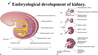 RENAL ANAMOLY PPT 2025 NEW RECENT ADVANCE | PPTX