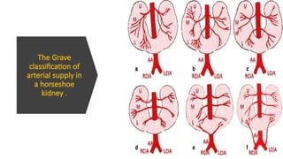 RENAL ANAMOLY PPT 2025 NEW RECENT ADVANCE | PPTX