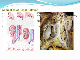 Renal anomalies | PPTX
