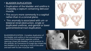 Comprehensive Overview of Congenital Renal Anomalies and Developmental ...