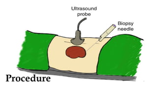 Biopsy Blade - Conf. 20 Pz.