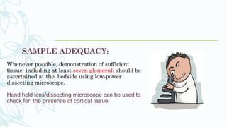 SAMPLE ADEQUACY:
Whenever possible, demonstration of sufficient
tissue including at least seven glomeruli should be
ascertained at the bedside using low-power
dissecting microscope.
Hand held lens/dissecting microscope can be used to
check for the presence of cortical tissue.
 