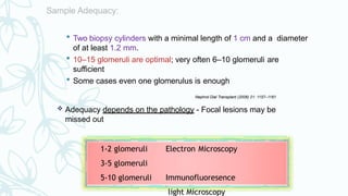  Two biopsy cylinders with a minimal length of 1 cm and a diameter
of at least 1.2 mm.
 10–15 glomeruli are optimal; very often 6–10 glomeruli are
sufficient
 Some cases even one glomerulus is enough
Nephrol Dial Transplant (2006) 21: 1157–1161
 Adequacy depends on the pathology - Focal lesions may be
missed out
1-2 glomeruli
3-5 glomeruli
5-10 glomeruli
Electron Microscopy
Immunofluoresence
light Microscopy
 