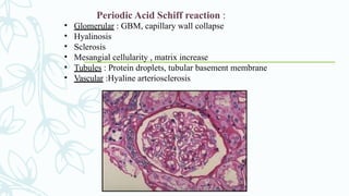 Periodic Acid Schiff reaction :
• Glomerular : GBM, capillary wall collapse
• Hyalinosis
• Sclerosis
• Mesangial cellularity , matrix increase
• Tubules : Protein droplets, tubular basement membrane
• Vascular :Hyaline arteriosclerosis
 