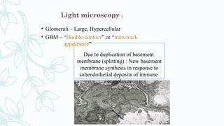 Light microscopy :
• Glomeru
• GBM –
li – Large, Hypercellular
“Double-contour” or “tram-track
appearance”
Due to duplication of basement
membrane (splitting) : New basement
membrane synthesis in response to
subendothelial deposits of immune
complexes
 