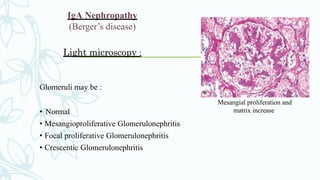 IgA Nephropathy
(Berger’s disease)
Light microscopy :
Glomeruli may be :
• Normal
• Mesangioproliferative Glomerulonephritis
• Focal proliferative Glomerulonephritis
• Crescentic Glomerulonephritis
Mesangial proliferation and
matrix increase
 