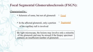 Focal Segmental Glomerulosclerosis (FSGN):
Characterised by :
 Focal
• Sclerosis of some, but not all glomeruli
• In the affected glomeruli, only a portion
of the capillary tuft is involved
 Segmental
By light microscopy, the lesions may involve only a minority
of the glomeruli and may be missed if the biopsy specimen
contains an insufficient number of glomeruli
 