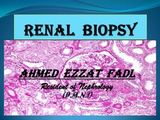 Ahmed Ezzat Fadl
Resident of Nephrology
(D.M.N.I)
 