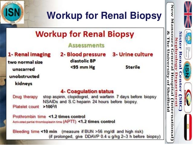 Renal Biopsy Nadia