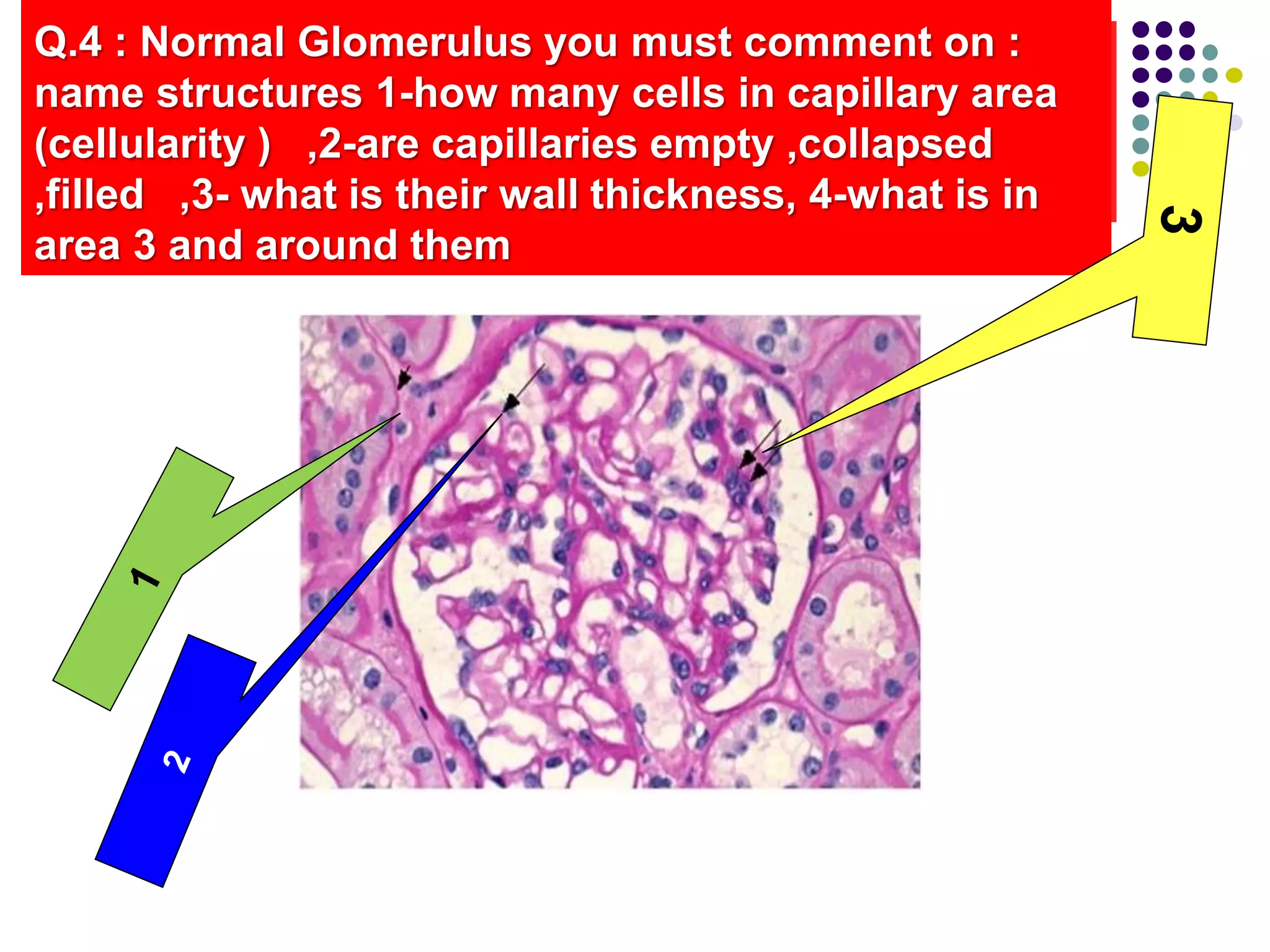 Q.4 : Normal Glomerulus you must comment on :
name structures 1-how many cells in capillary area
(cellularity ) ,2-are capillaries empty ,collapsed
,filled ,3- what is their wall thickness, 4-what is in
area 3 and around them
 