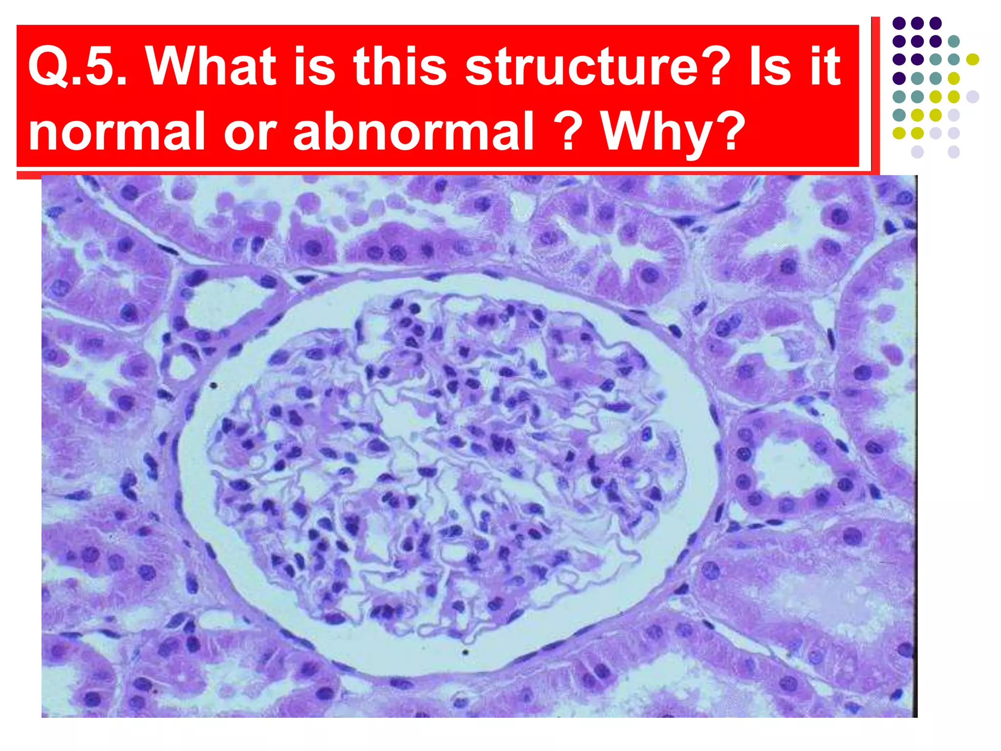 Q.5. What is this structure? Is it
normal or abnormal ? Why?
 