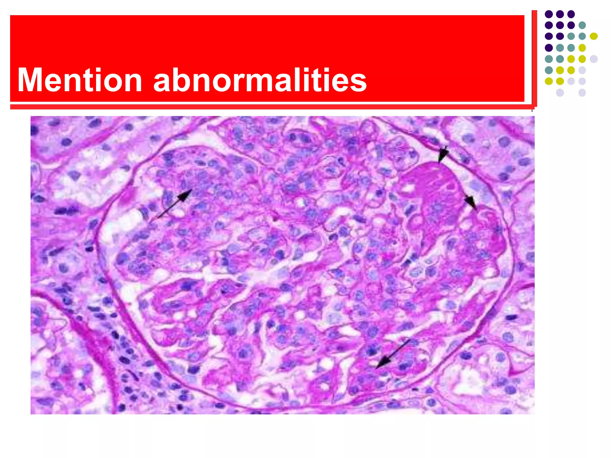 Mention abnormalities
 