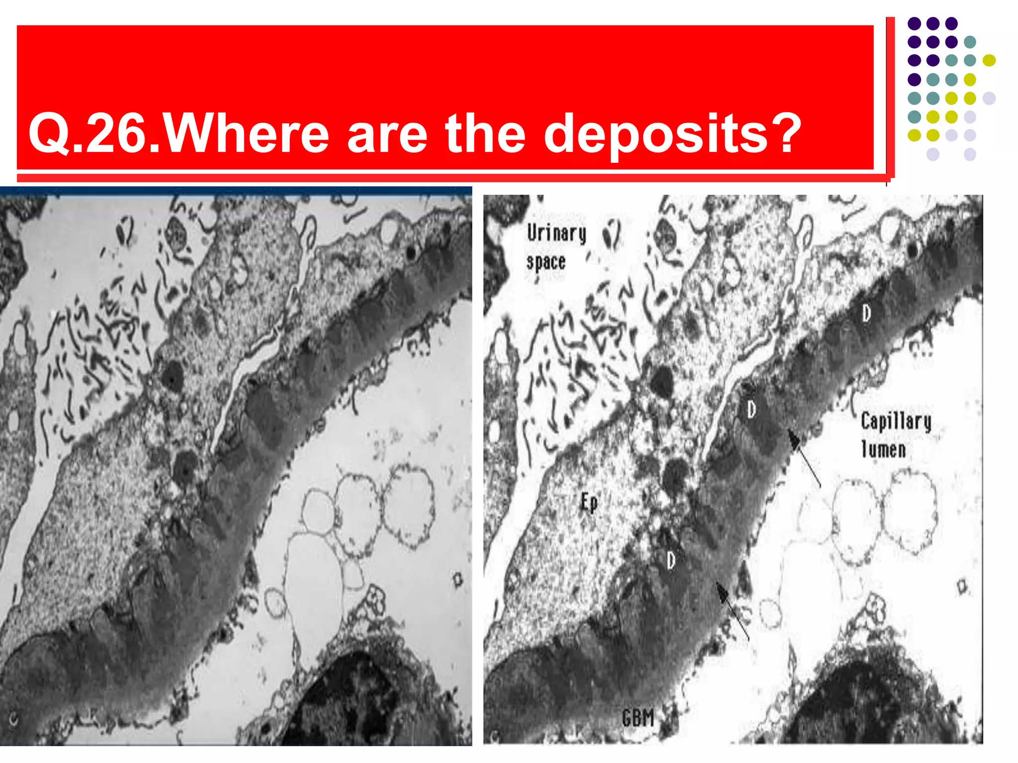 Q.26.Where are the deposits?
 
