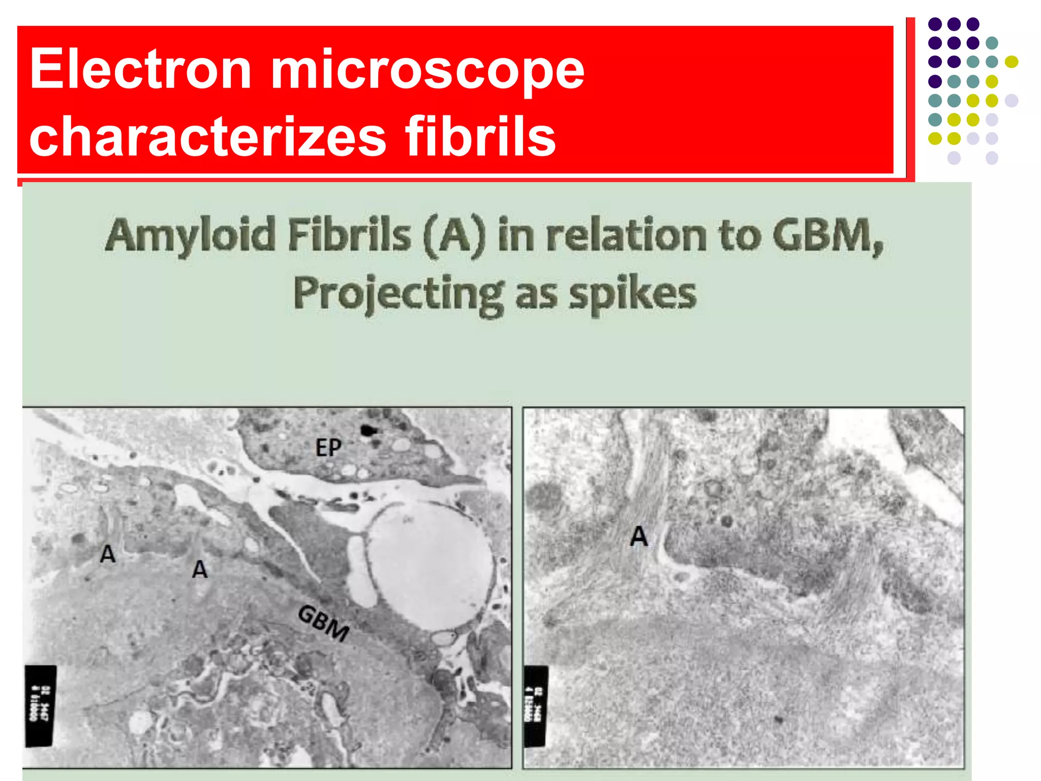 Electron microscope
characterizes fibrils
 
