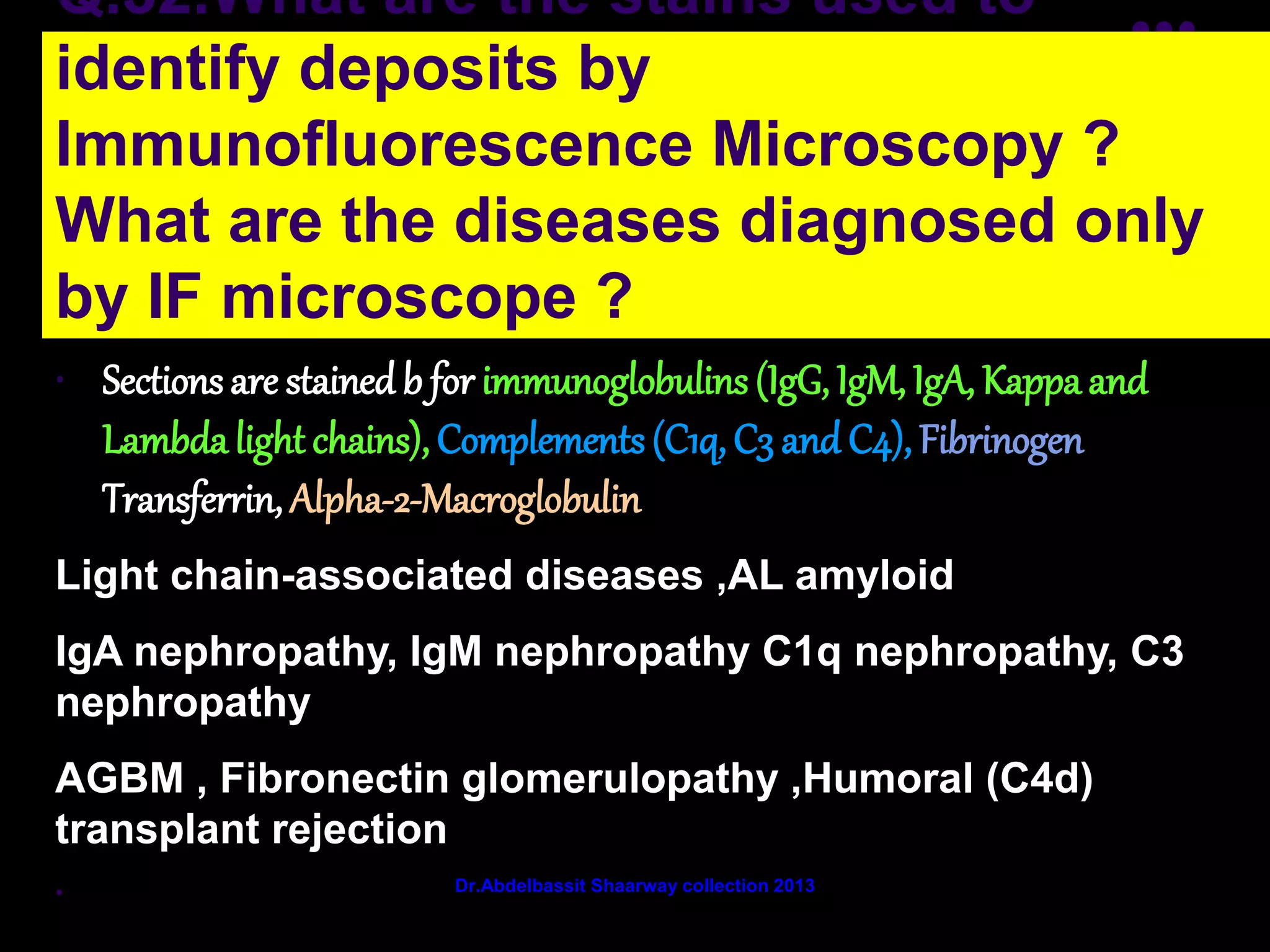 Q.32.What are the stains used to
identify deposits by
Immunofluorescence Microscopy ?
What are the diseases diagnosed only
by IF microscope ?
• Sections are stained b for immunoglobulins (IgG, IgM, IgA, Kappa and
Lambda light chains), Complements (C1q, C3 and C4), Fibrinogen,
Transferrin, Alpha-2-Macroglobulin.,
Light chain-associated diseases ,AL amyloid
IgA nephropathy, IgM nephropathy C1q nephropathy, C3
nephropathy
AGBM , Fibronectin glomerulopathy ,Humoral (C4d)
transplant rejection
• Dr.Abdelbassit Shaarway collection 2013
 