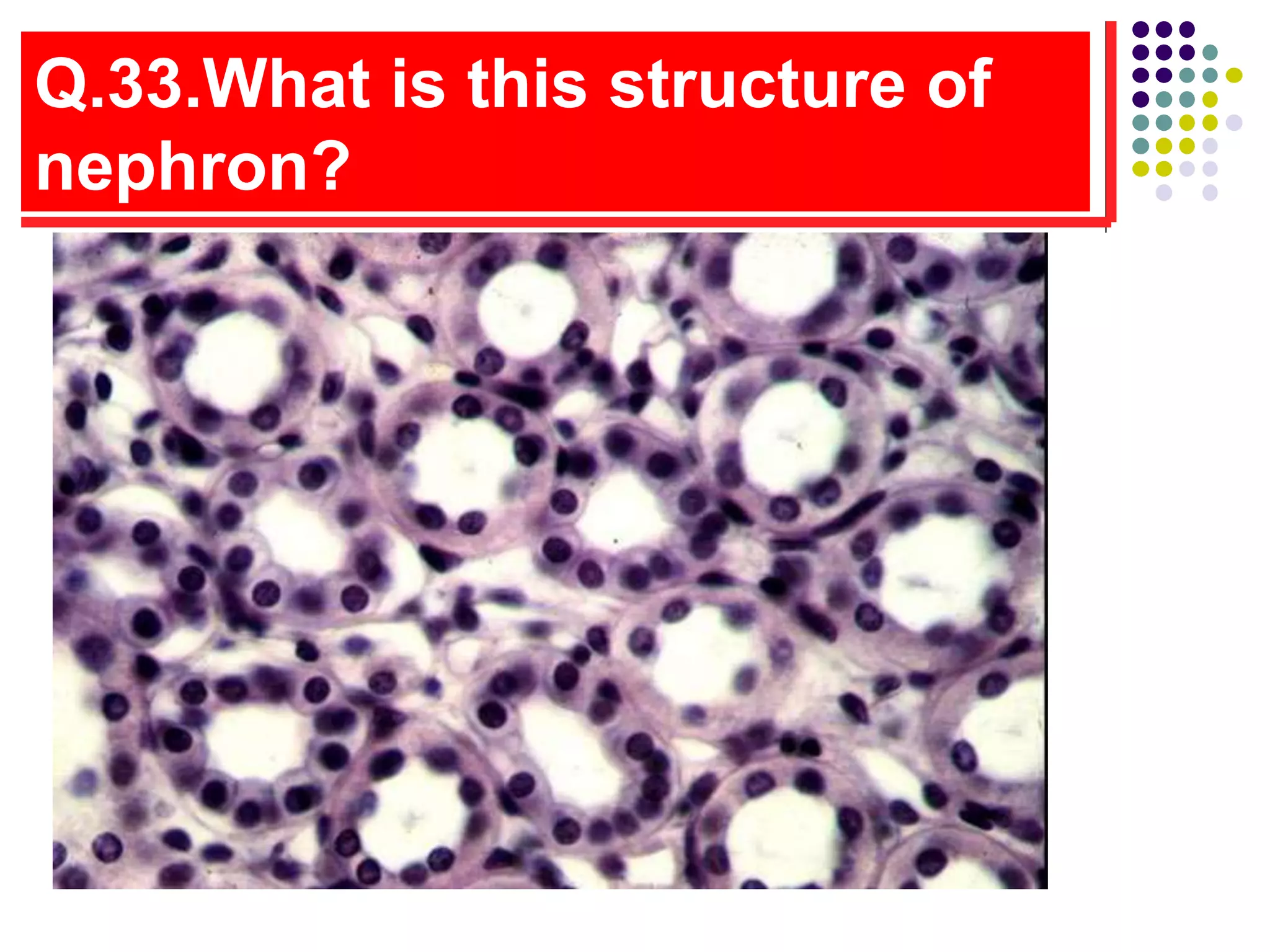 Q.33.What is this structure of
nephron?
 