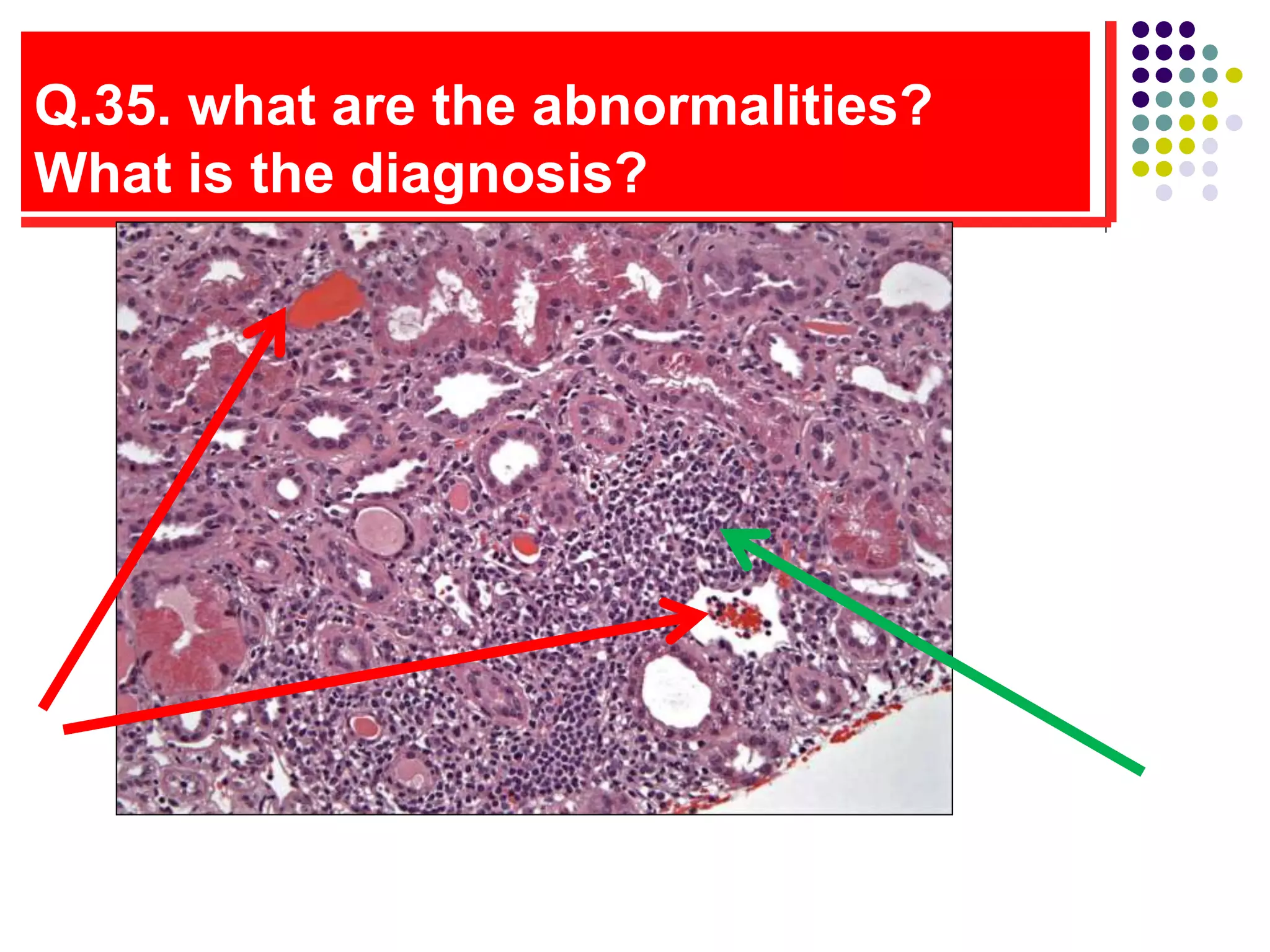 Q.35. what are the abnormalities?
What is the diagnosis?
 