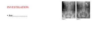 INVESTIGATION
• Are……………………
 