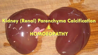 Kidney (Renal) Parenchyma Calcification & HOMOEOPATHY (गुर्दा सूखने, पथरी होम्योपैथी उपचार)