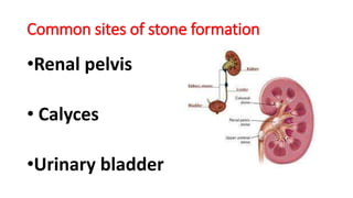 Common sites of stone formation
•Renal pelvis
• Calyces
•Urinary bladder
 