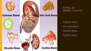 T YPES OF
RENAL CALCULI
Calcium stone
Uric acid stone
Struvite stone
Cystine stone
 