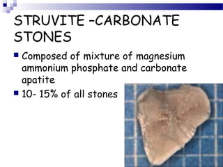 STRUVITE –CARBONATE
STONES
 Composed of mixture of magnesium
ammonium phosphate and carbonate
apatite
 10- 15% of all stones
 