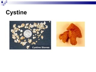 Cystine
 