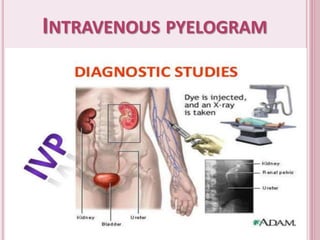 INTRAVENOUS PYELOGRAM
 