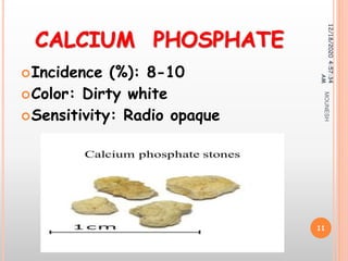 CALCIUM PHOSPHATE
Incidence (%): 8-10
Color: Dirty white
Sensitivity: Radio opaque
12/18/20204:57:34
AM
11
MOUNESH
 