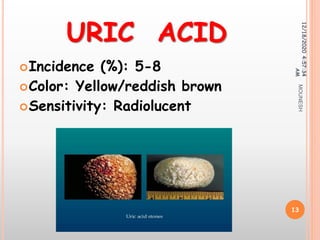 URIC ACID
Incidence (%): 5-8
Color: Yellow/reddish brown
Sensitivity: Radiolucent
12/18/20204:57:34
AM
13
MOUNESH
 