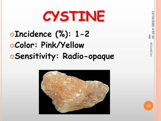CYSTINE
Incidence (%): 1-2
Color: Pink/Yellow
Sensitivity: Radio-opaque
12/18/20204:57:34
AM
14
MOUNESH
 
