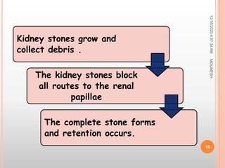 Kidney stones grow and
collect debris .
The kidney stones block
all routes to the renal
papillae
The complete stone forms
and retention occurs.
12/18/20204:57:34AM
18
MOUNESH
 