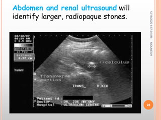 12/18/20204:57:34AM
28
Abdomen and renal ultrasound will
identify larger, radiopaque stones.
MOUNESH
 