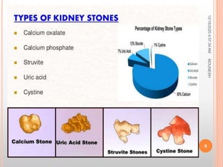 12/18/20204:57:34AM
9
MOUNESH
 