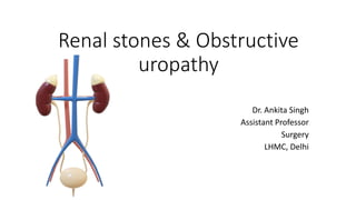 Renal stones & Obstructive
uropathy
Dr. Ankita Singh
Assistant Professor
Surgery
LHMC, Delhi
 