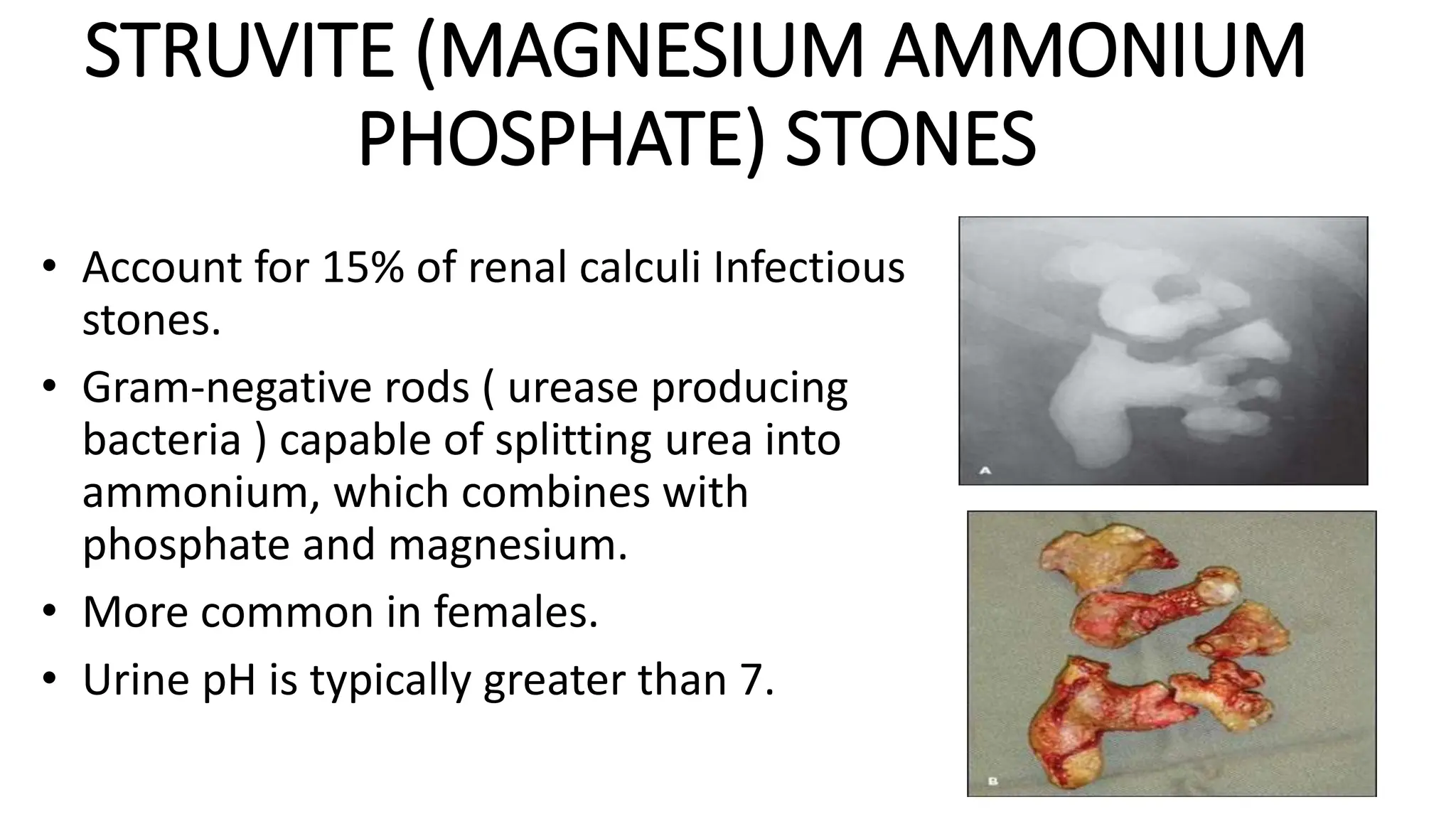 RENAL CALCULI PRESENTATION FINAL COPY.pptx