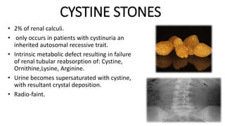 CYSTINE STONES
• 2% of renal calculi.
• only occurs in patients with cystinuria an
inherited autosomal recessive trait.
• Intrinsic metabolic defect resulting in failure
of renal tubular reabsorption of: Cystine,
Ornithine,Lysine, Arginine.
• Urine becomes supersaturated with cystine,
with resultant crystal deposition.
• Radio-faint.
 