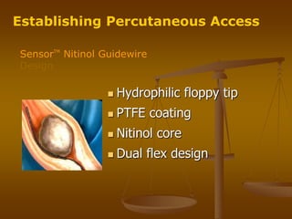  Hydrophilic floppy tip
 PTFE coating
 Nitinol core
 Dual flex design
SensorTM
Nitinol Guidewire
Design
Establishing Percutaneous Access
 