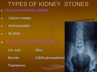 TYPES OF KIDNEY STONES
 CALCIUM CONTAINIG STONES
 Calcium oxalate
 Hydroxyapatite
 Brushite
 NON CALCIUM CONTAINIG STONE
Uric acid Silica
Struvite 2,8Dihydroxyadenine
Triamterene
 