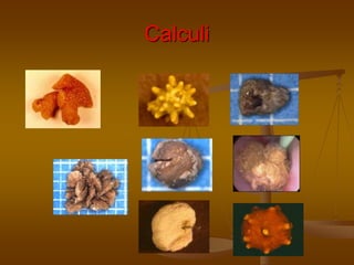Calculi
 