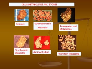 Indinavir Sulfamethoxazole
Metabolite
Triamterene and
Metabolites
Ciprofloxacin
Metabolite Aminophylline
Phenytoin Metabolite
DRUG METABOLITES AND STONES
 