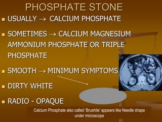 PHOSPHATE STONE
 USUALLY CALCIUM PHOSPHATE
 SOMETIMES  CALCIUM MAGNESIUM
AMMONIUM PHOSPHATE OR TRIPLE
PHOSPHATE
 SMOOTH MINIMUM SYMPTOMS
 DIRTY WHITE
 RADIO - OPAQUE
Calcium Phosphate also called ‘Brushite’ appears like Needle shape
under microscope
 