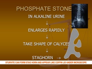 PHOSPHATE STONES
IN ALKALINE URINE

ENLARGES RAPIDLY

TAKE SHAPE OF CALYCES

STAGHORN 
 