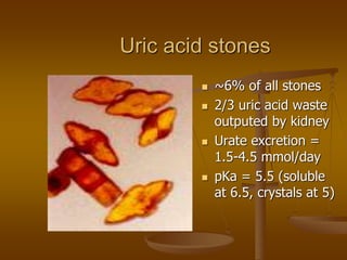 Uric acid stones
 ~6% of all stones
 2/3 uric acid waste
outputed by kidney
 Urate excretion =
1.5-4.5 mmol/day
 pKa = 5.5 (soluble
at 6.5, crystals at 5)
 