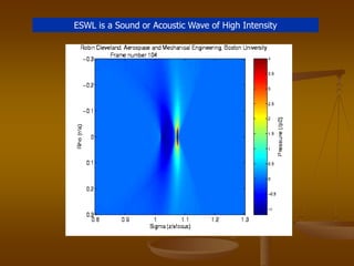 ESWL is a Sound or Acoustic Wave of High Intensity
 
