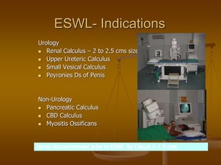 ESWL- Indications
Urology
 Renal Calculus – 2 to 2.5 cms size
 Upper Ureteric Calculus
 Small Vesical Calculus
 Peyronies Ds of Penis
Non-Urology
 Pancreatic Calculus
 CBD Calculus
 Myositis Ossificans
Stents Recommended prior to ESWL for Calculi > 1.5 cms
 