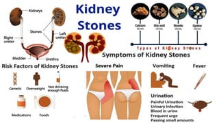 Renal calculus.pptx
